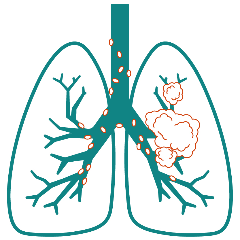 Lungs-Banner